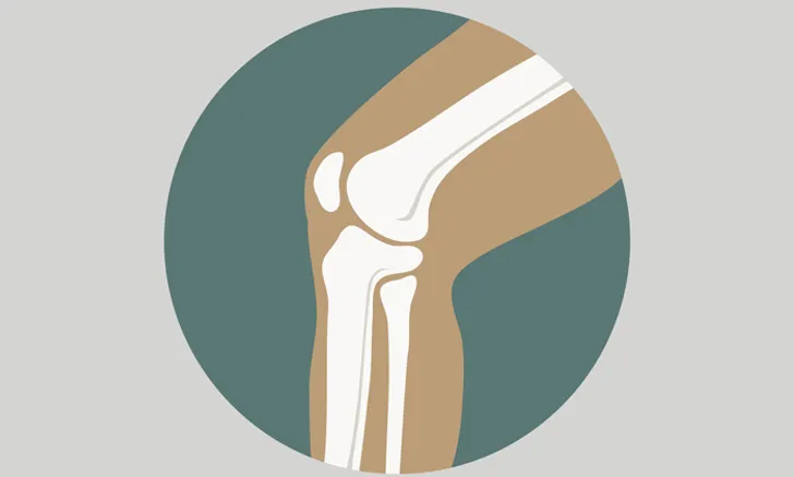 5 exercises knee osteoarthritis solution